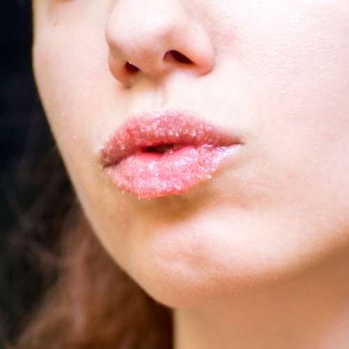 Mango Lip Scrub - N S Cosmetics 